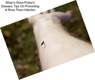 What Is Rose Picker\'s Disease: Tips On Preventing A Rose Thorn Infection